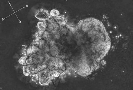 Figure 2. Antero-Posterior patterned endoderm organoid grown from human iPSC.